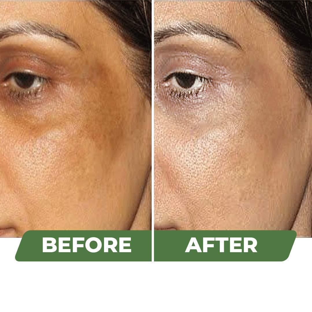 Crème éclaircissante bio pour la peau 100 g (Lot de 2)