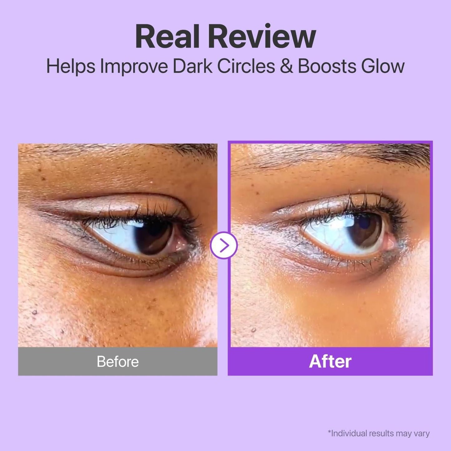 Crème contour des yeux Volumetox 100 g